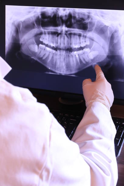 Best Emergency Tooth Extraction in Clear Lake, WA
